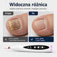 Męczy Cię ręczne opiłowywanie grubych paznokci, które zajmuje wieczność? – elektryczna pilniczka do paznokci z wysokim momentem obrotowym – wypróbuj szybkie i równomierne opiłowanie bez wysiłku. Na pobranie! 💅